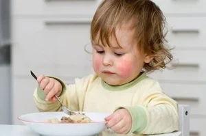 Food allergy in babies